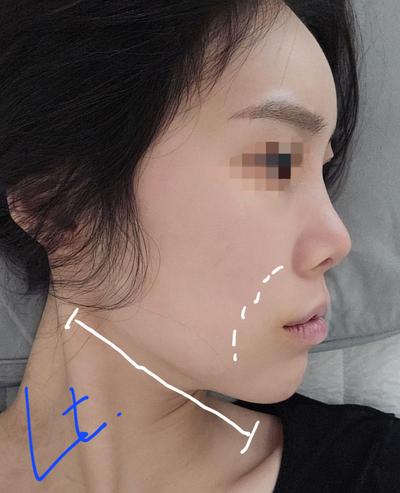 후기 사진 2