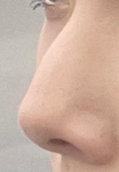 후기 사진 2