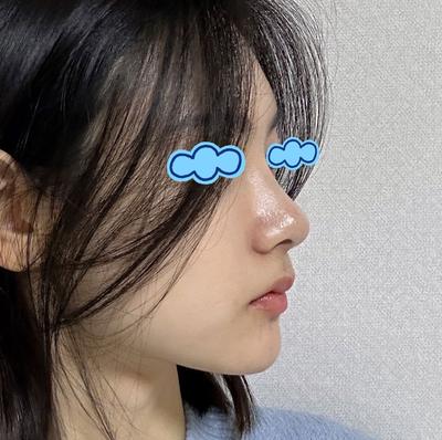 후기 사진 4