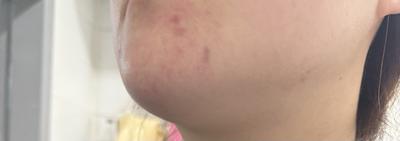 후기 사진 1
