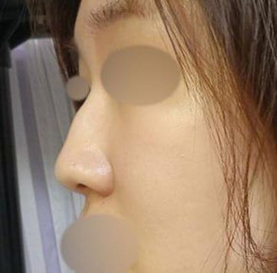 후기 사진 1