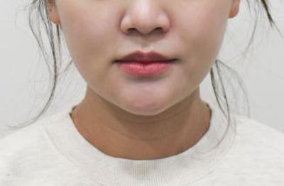 후기 사진 2