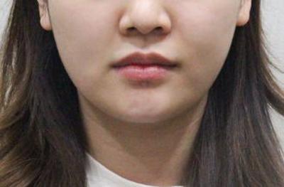 후기 사진 1