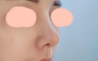 후기 사진 2