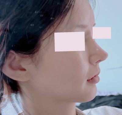 후기 사진 1