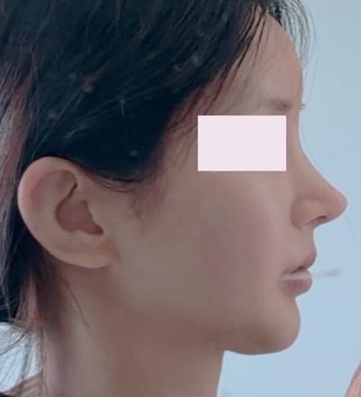 후기 사진 2