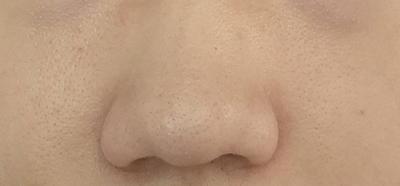 후기 사진 2