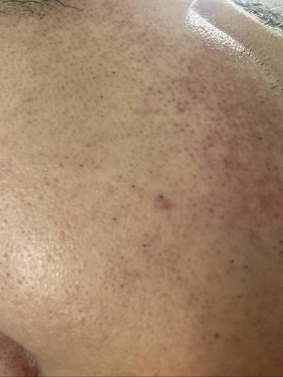 후기 사진 1