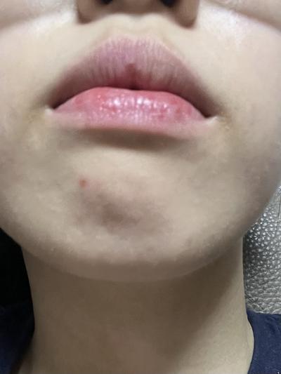 후기 사진 4