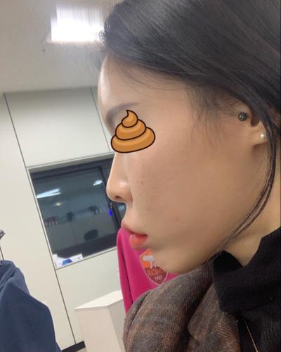 후기 사진 1