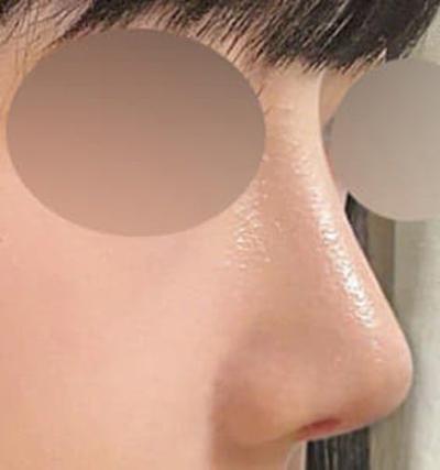 후기 사진 1