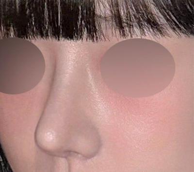 후기 사진 3