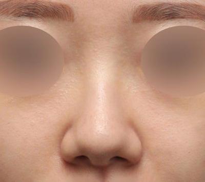 후기 사진 5