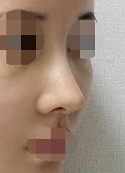 후기 사진 1