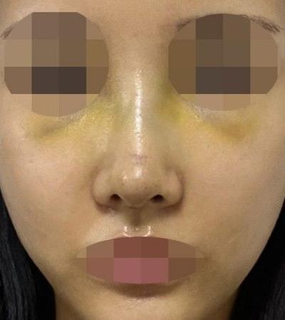 후기 사진 2