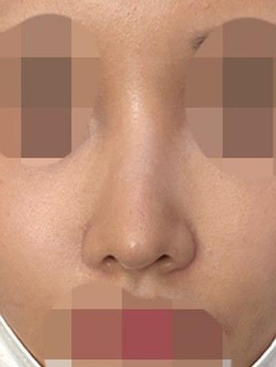 후기 사진 3