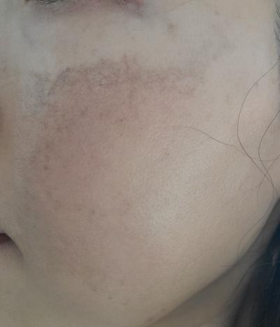 후기 사진 1