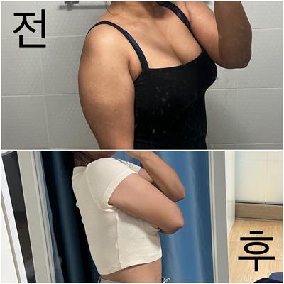 후기 사진 1