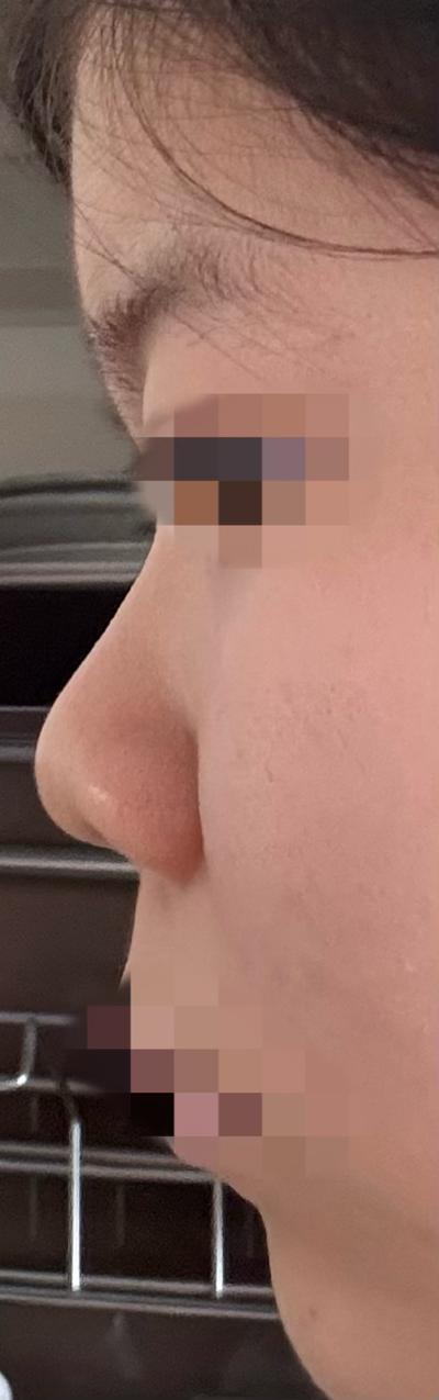 후기 사진 2