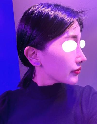 후기 사진 2